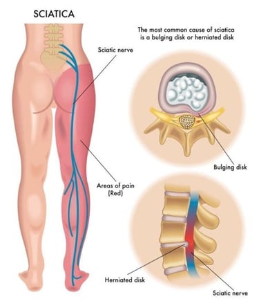best spine doctor in jayanagar