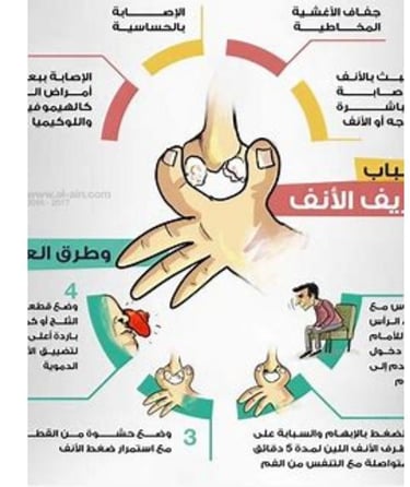 🩸🍯 اكتشف كيف يمكن للعسل أن يوقف نزيف الأنف (الرعاف) طبيعيًا بفضل خصائصه المرمّمة والمطهّرة. تعرّف