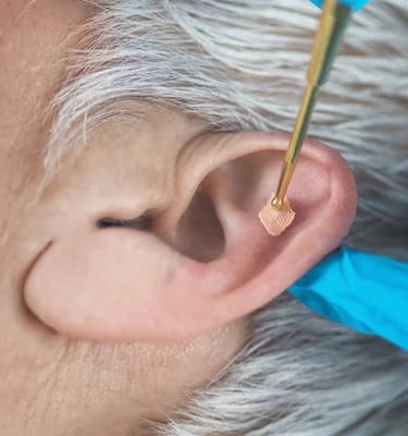 Réflexologie Auriculaire