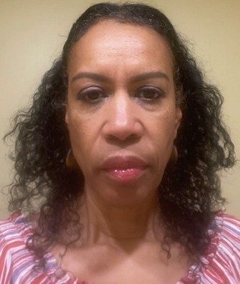 before image of thinning hair prior to botanical oil use