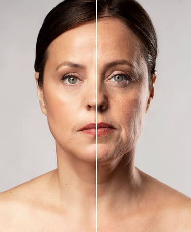 facelift beforeafter photo