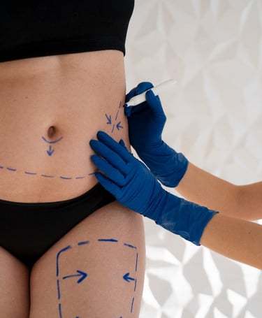 "tummy tuck" is a cosmetic surgery procedure used to make the abdomen thinner and more firm.