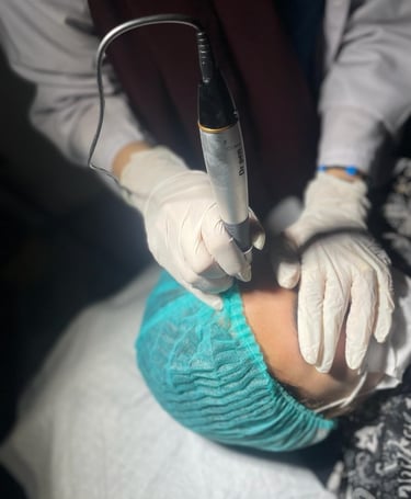 Facial rejuvination, dark circles, dark spots, scars, more removal, skin tags, acne scars, hair fall