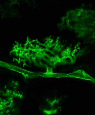 Mychorhize de Rhizophagus regulare observée par microscope à fluorescence