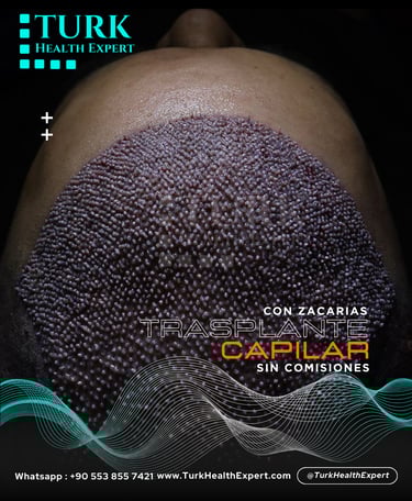 hair grafts