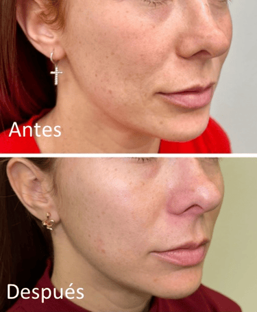 Produccion de colageno