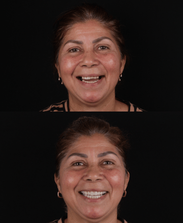 RECORTAR FUNDO DESTA IMAGEM 