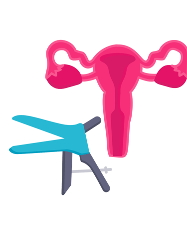 utérus et dépistage du cancer, la sage femme effectue un frottis