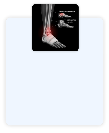Dr-Sergio-pe-e-tornozelo-ortopedista-especializado-em-cirurgia-de-pe-e-tornozelo-em-rondonopolis-mt