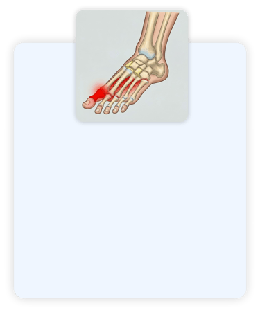 Dr-Sergio-pe-e-tornozelo-ortopedista-especializado-em-cirurgia-de-pe-e-tornozelo-em-rondonopolis-mt