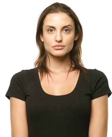 Before Hair Enhancement by Ilona provides hair loss and thinning solution she needs help