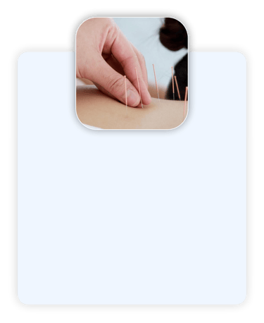 Acupuntura para equilíbrio energético e controle da dor.