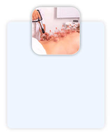 Ventosaterapia para alívio de dores, melhora da circulação e relaxamento profundo