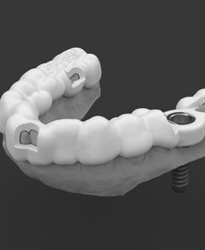 Dental Implant Surgical guide / Template