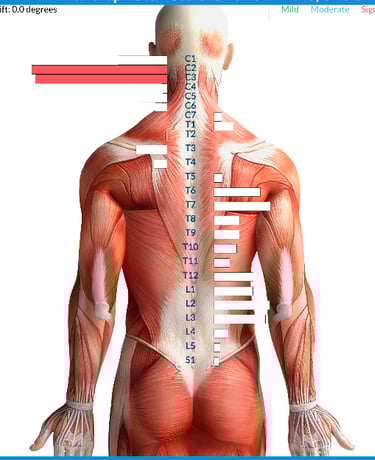 Vagus nerve stress from birth trauma causing tongue tie and latching issues