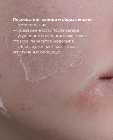 Борьба с фотостарением