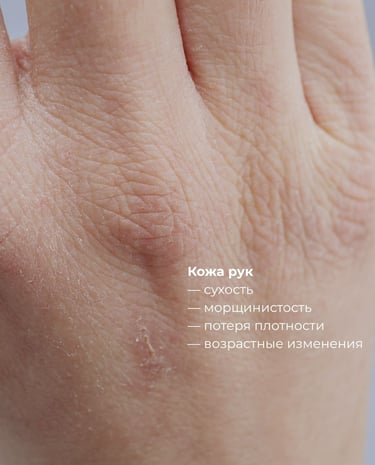 Глубокое увлаженение, выработка коллагена, сыворотка i-PRF насыщенная фибрином и факторами роста