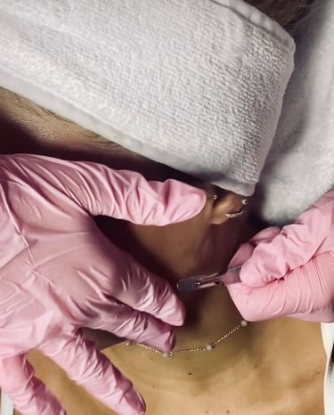derma plane facial by mallory at vanity esthetics located at Meraki and co salon and spa 
