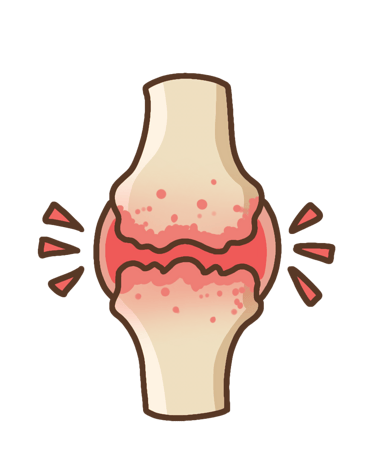 arthrose-osteopathe-strasbourg