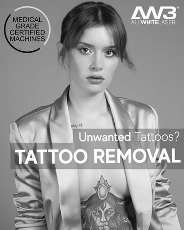 a tattoo removal advertising poster