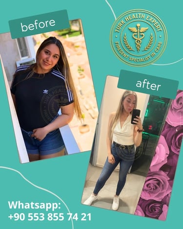 Galería de Fotos Antes y Después de Manga Gástrica turquia
