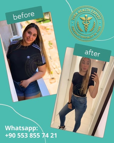 Galería de Fotos Antes y Después de Manga Gástrica