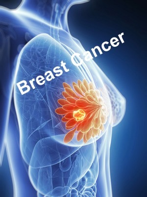 Examples of foods to help cure cancer