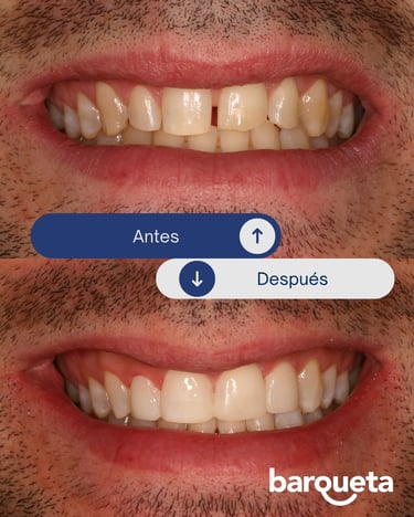 paciente satisfecho tras tratamiento invisalign en sevilla