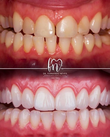 a before and after image of dental treatment