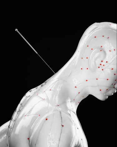 Points d'acupuncture sur Crolles et national Geographic