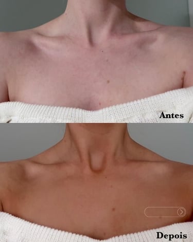 antes e depois do bronzeamento