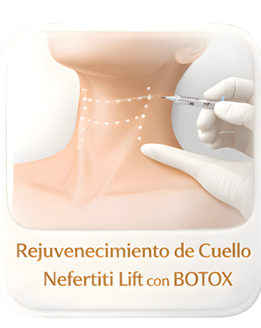 Nefertiti Lift neck rejuvenation treatment using Botox injections for jawline tightening.