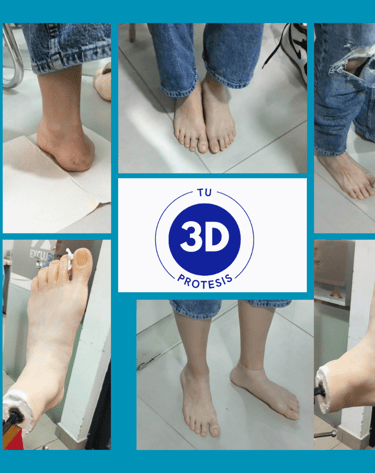 Protesis para pie, protesis en silicona para personas que no tienen alguna parte de su cuerpo