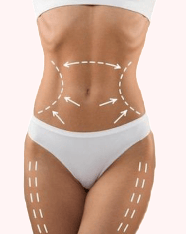 lipo enzimatica em bh