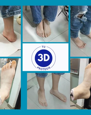 Protesis para pie, protesis en silicona para personas que no tienen alguna parte de su cuerpo
