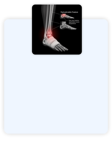 Dr-Sergio-pe-e-tornozelo-ortopedista-especializado-em-cirurgia-de-pe-e-tornozelo-em-rondonopolis-mt