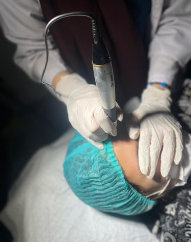 Facial rejuvination, dark circles, dark spots, scars, more removal, skin tags, acne scars, hair fall