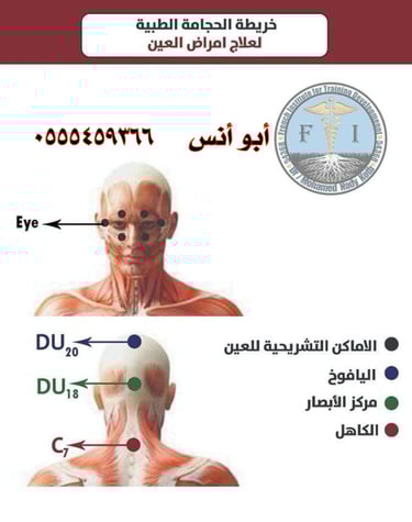 حجامه منزليه بمكه
