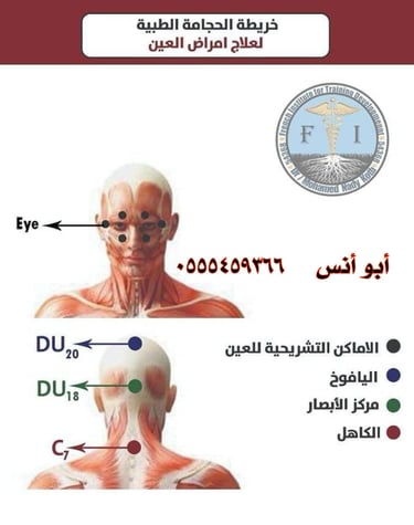 حجامه منزليه
