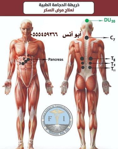 ابو انس للحجامه