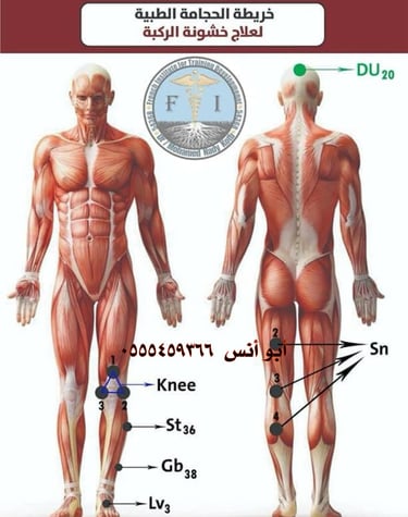 اخصائي حجامه منزليه مكه