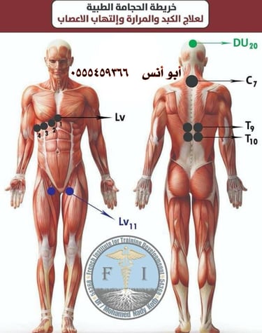 حجامه في مكة