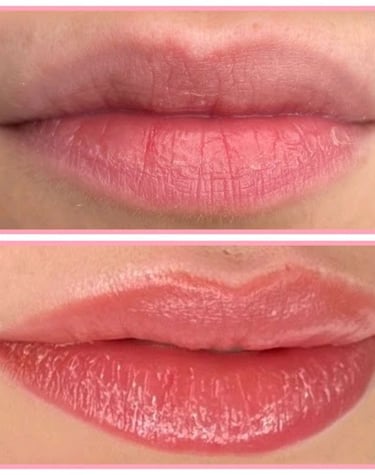 Permanent Make-up Lippen Vorher Nachher Fotos Lippenpigmentierung Lip Blush