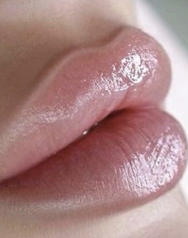 harmonização labial bh