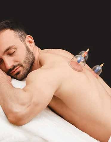 cupping massage in wollongong - part of sports massage
