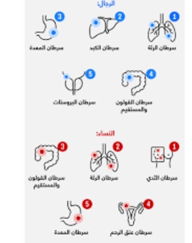 واكثر السرطان انتشارا الرحال والنساء