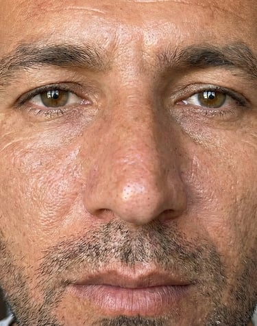 Diyarbakır profesyonel cilt bakımı uygulaması