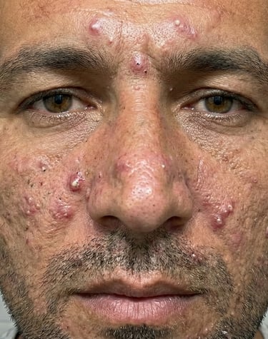 Diyarbakır profesyonel cilt bakımı uygulaması