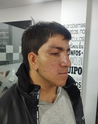 Protesis para orjas en silicona fabricada por anaplastologo clinico