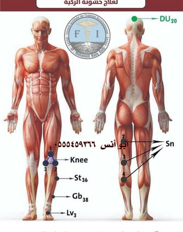 حجامه منزليه مكه
